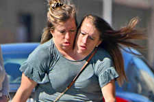 Incredible Story: Twins Separated After Being Conjoined!