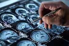 Dementia and Memory Loss Have Been Linked to a Common Habit. Do You Do It?