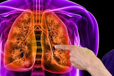 Simple Method Removes Mucus From Lungs (It's Genius)