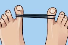 Lymph Fluid? Do This if Get Rid of Edema Swelling