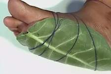 Neuropaty is Not From Low Vitamin B (Meet the Real Enemy)