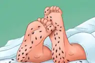 Neuropathy is Not From Low Vitamin B (Meet The Real Enemy)