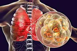 How to Remove All Mucus From Your Lungs (It's Genius)
