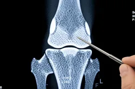 Surgeon Reveals: This Simple Trick Will End Joint Pain & Arthritis! (Try It)