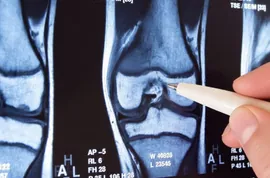 Surgeon Reveals: This Simple Trick Will End Joint Pain & Arthritis! (Try It)