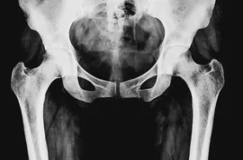 Surgeon Reveals: This Simple Trick Will End Joint Pain & Arthritis! (Try It)