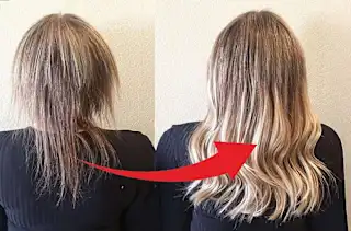 Hair Grows Back in a Few Days! At Any Stage of Baldness