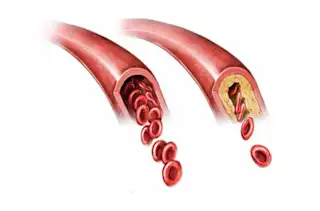 If You Have Diabetes & Blood Pressure is Above 120/80, You Should Consider This!