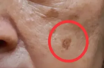 MD: If You Have Dark Spots, Do This Immediately (It's Genius!)