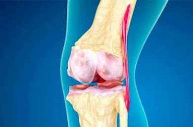 Doctors Baffled: Simple Tip Relieves Years of Joint Pain and Arthritis