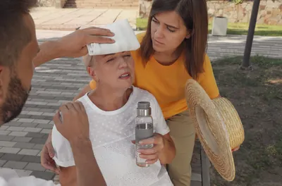 Lupus and Sun Exposure