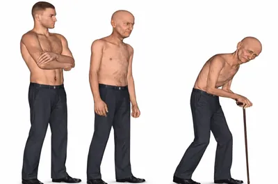 Doctor Begs Seniors: Do This to Stop Losing Muscle