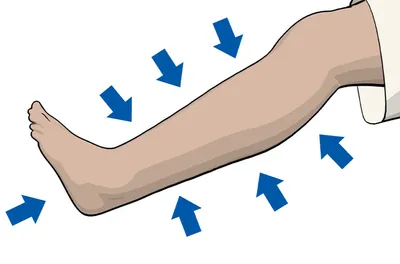 How to Drain Lymph Fluid in Ankles & Legs?