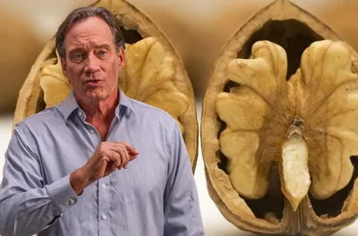Kevin Sorbo: 4 Early Signs of Dementia (#2 is Scary)